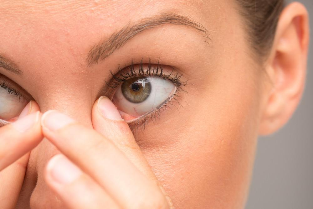 7 Tips for Avoiding Eye Infections - Classic Vision Care